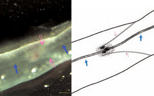 A stereomicroscopic image of the lymphatic vessel around the caudal vena cava of a rat.